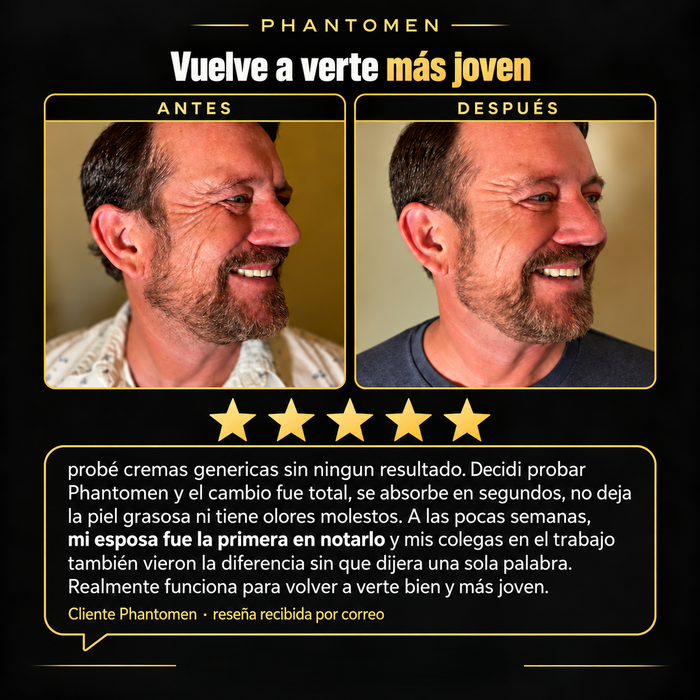 Antes y después cliente Phantomen